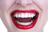 Small Blood Tipped Deluxe Fangs